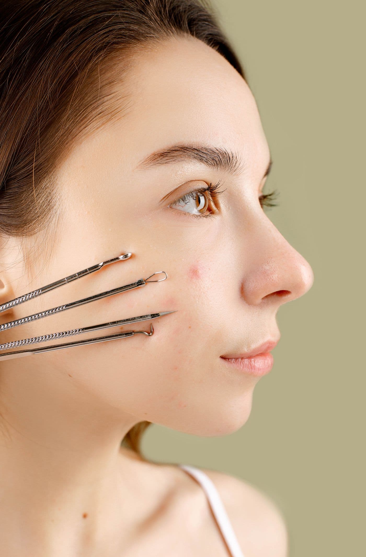 Microneedling